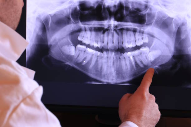 Best After-Hours Emergency Dentist in Bay City, OR
