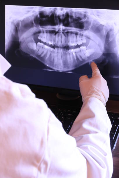 Best Emergency Root Canal Treatment in Bay City, OR